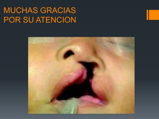 Labios Rombicos Embriologia, anatomia y clasificacion de labio y | PPTX