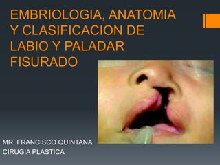 EMBRIOLOGIA, ANATOMIA
Y CLASIFICACION DE
LABIO Y PALADAR
FISURADO
MR. FRANCISCO QUINTANA
CIRUGIA PLASTICA
 