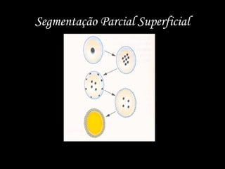 Segmentação Parcial Superficial
 