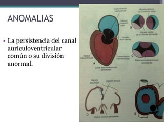 ANOMALIAS
• La persistencia del canal
auriculoventricular
común o su división
anormal.

 