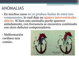 ANOMALIAS
• En muchos casos no se produce fusión de estos tres
componentes, lo cual deja un agujero interventricular
abierto. Si bien esta anomalía puede aparecer
aisladamente, con frecuencia se encuentra combinada
con otros defectos compensadores.
• Malformación
cardiaca mas
común.

 