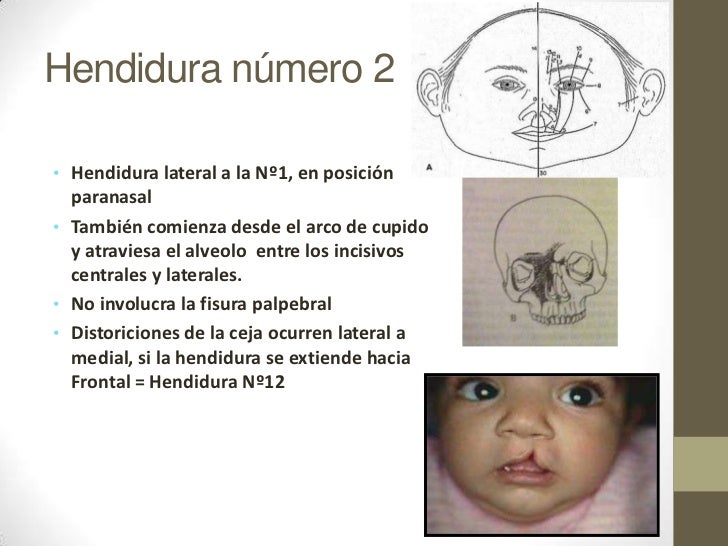 Embriologia del complejo craneofacial