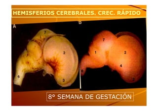 HEMISFERIOS CEREBRALES. CREC. RÁPIDO




         8° SEMANA DE GESTACIÓN
 