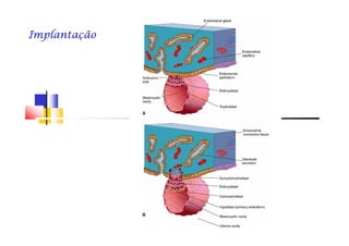 ImplantaçãoImplantaçãoImplantaçãoImplantaçãoImplantaçãoImplantaçãoImplantaçãoImplantação
 