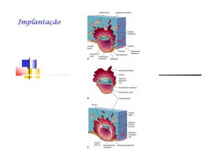 ImplantaçãoImplantaçãoImplantaçãoImplantaçãoImplantaçãoImplantaçãoImplantaçãoImplantação
 