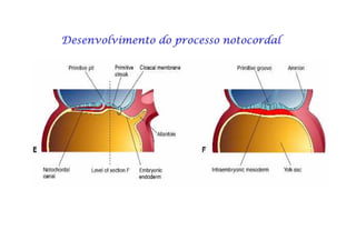 Desenvolvimento do processo notocordalDesenvolvimento do processo notocordalDesenvolvimento do processo notocordalDesenvolvimento do processo notocordalDesenvolvimento do processo notocordalDesenvolvimento do processo notocordalDesenvolvimento do processo notocordalDesenvolvimento do processo notocordal
 