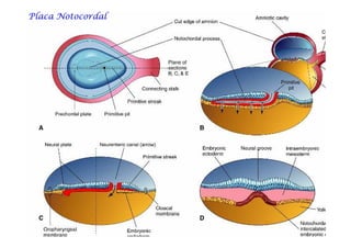Placa NotocordalPlaca NotocordalPlaca NotocordalPlaca NotocordalPlaca NotocordalPlaca NotocordalPlaca NotocordalPlaca Notocordal
 