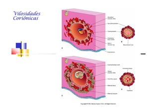 VilosidadesVilosidadesVilosidadesVilosidadesVilosidadesVilosidadesVilosidadesVilosidades
CoriônicasCoriônicasCoriônicasCoriônicasCoriônicasCoriônicasCoriônicasCoriônicas
 