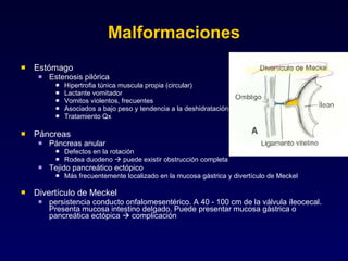 Malformaciones Estómago Estenosis pilórica Hipertrofia túnica muscula propia (circular) Lactante vomitador Vomitos violentos, frecuentes Asociados a bajo peso y tendencia a la deshidratación Tratamiento Qx Páncreas Páncreas anular Defectos en la rotación Rodea duodeno    puede existir obstrucción completa Tejido pancreático ectópico Más frecuentemente localizado en la mucosa gástrica y divertículo de Meckel  Divertículo de Meckel persistencia conducto onfalomesentérico. A 40 - 100 cm de la válvula íleocecal. Presenta mucosa intestino delgado. Puede presentar mucosa gástrica o pancreática ectópica    complicación 