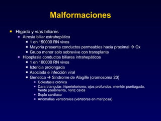 Malformaciones Hígado y vías biliares Atresia biliar extrahepática 1 en 150000 RN vivos Mayoria presenta conductos permeables hacia proximal    Cx Grupo menor solo sobrevive con transplante Hipoplasia conductos biliares intrahepáticos 1 en 100000 RN vivos Ictericia prolongada Asociada e infección viral Genetica    Sindrome de Alagille (cromosoma 20) Colestasis crónica Cara triangular, hipertelorismo, ojos profundos, mentón puntiagudo, frente prominente, nariz caída Soplo cardíaco Anomalías vertebrales (vértebras en mariposa) 