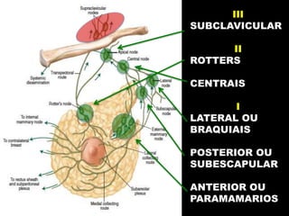 III
SUBCLAVICULAR
II
ROTTERS
CENTRAIS
I
LATERAL OU
BRAQUIAIS
POSTERIOR OU
SUBESCAPULAR
ANTERIOR OU
PARAMAMARIOS
 