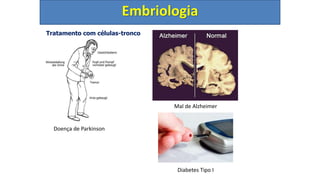 Tratamento com células-tronco
Embriologia
Doença de Parkinson
Mal de Alzheimer
Diabetes Tipo I
 