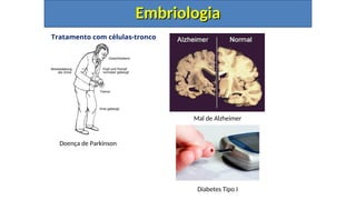 Tratamento com células-tronco
Embriologia
Embriologia
Doença de Parkinson
Mal de Alzheimer
Diabetes Tipo I
 