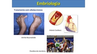Tratamento com células-tronco
Embriologia
Embriologia
Artrite Reumatóide
Mal de Alzheimer
Diabetes Tipo I
Infarto Cardíaco
Paralisia de membros
 