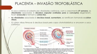 PLACENTA – INVASÃO TROFOBLÁSTICA
• O saco coriônico é coberto por vilosidades coriônicas, com o crescimento 8ª semana, as
vilosidades associadas à decídua capsular (voltadas para o concepto) degeneram,
ficam avascular e formam o córion liso.
• As vilosidades associadas à decídua basal, aumentam, se ramificam formando o córion
viloso.
• O córion viloso firma-se à decídua basal pela capa citotrofoblástica e ancoram o saco
coriônico;
 
