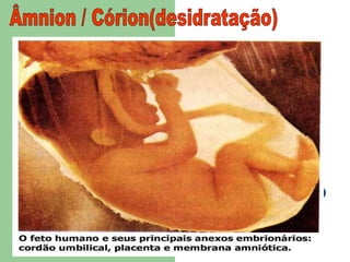 Âmnion / Córion(desidratação)