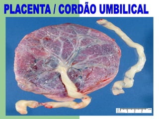 PLACENTA / CORDÃO UMBILICAL