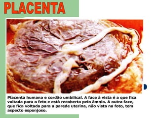 PLACENTA