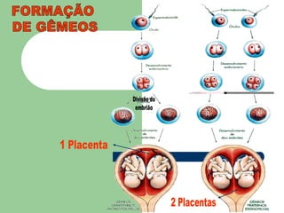 FORMAÇÃO DE GÊMEOSDivisão doembrião1 Placenta2 Placentas