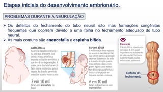 Etapas iniciais do desenvolvimento embrionário.
11
Defeito do
fechamento
 