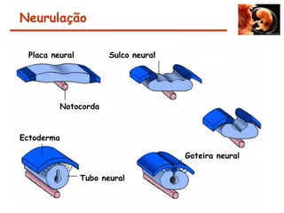 Neurulação
Notocorda
Placa neural Sulco neural
Goteira neural
Tubo neural
Ectoderma
 