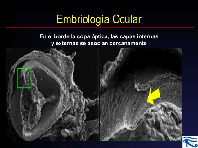 Embriologia Do Olho