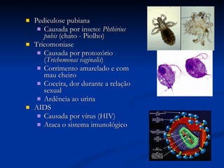 Pediculose pubiana Causada por inseto:  Phthirius pubis  (chato - Piolho) Tricomoniase Causada por protozório ( Trichomonas vaginalis )  Corrimento amarelado e com mau cheiro  Coceira, dor durante a relação sexual  Ardência ao urina  AIDS Causada por vírus (HIV) Ataca o sistema imunológico 