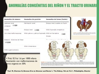 The Ninth Rector se presenta la embriologia renal a traves del tiempo | PPT