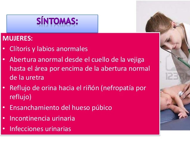 Un pequeño pene el miembro