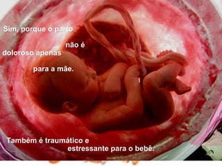 Sim, porque o parto

                  não é
doloroso apenas

        para a mãe.




 Também é traumático e
               estressante para o bebê.
 