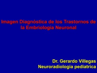 Imagen Diagnóstica de los Trastornos de
la Embriologia Neuronal
Dr. Gerardo Villegas
Neuroradiologia pediatrica
 