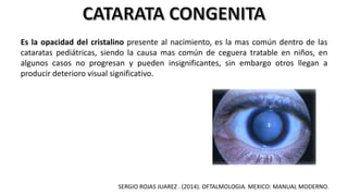 Es la opacidad del cristalino presente al nacimiento, es la mas común dentro de las
cataratas pediátricas, siendo la causa mas común de ceguera tratable en niños, en
algunos casos no progresan y pueden insignificantes, sin embargo otros llegan a
producir deterioro visual significativo.
SERGIO ROJAS JUAREZ . (2014). OFTALMOLOGIA. MEXICO: MANUAL MODERNO.
 