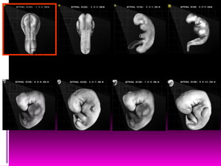 9
10
13 14 15
1
1
1
1
16
1211
 