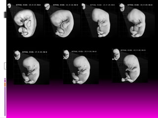 17 18
21
22 23
19 20
 