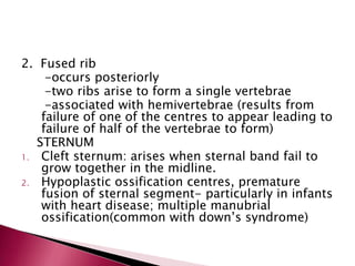 2. Fused rib
-occurs posteriorly
-two ribs arise to form a single vertebrae
-associated with hemivertebrae (results from
failure of one of the centres to appear leading to
failure of half of the vertebrae to form)
STERNUM
1. Cleft sternum: arises when sternal band fail to
grow together in the midline.
2. Hypoplastic ossification centres, premature
fusion of sternal segment- particularly in infants
with heart disease; multiple manubrial
ossification(common with down’s syndrome)

 
