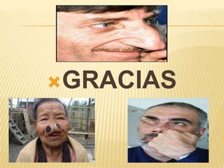 GRACIAS
 