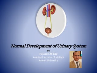 NormalDevelopmentofUrinarySystem
By
Hassaan Ali Gad
Assistant lecturer of urology
Aswan University
 