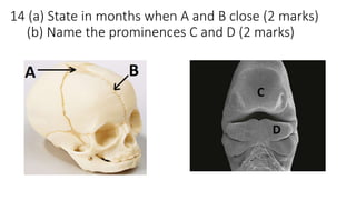 14 (a) State in months when A and B close (2 marks)
(b) Name the prominences C and D (2 marks)
 