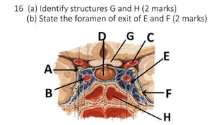 16 (a) Identify structures G and H (2 marks)
(b) State the foramen of exit of E and F (2 marks)
 