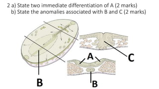 2 a) State two immediate differentiation of A (2 marks)
b) State the anomalies associated with B and C (2 marks)
 
