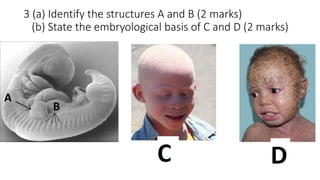 3 (a) Identify the structures A and B (2 marks)
(b) State the embryological basis of C and D (2 marks)
 