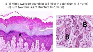 5 (a) Name two least abundant cell types in epithelium A (2 marks)
(b) Give two varieties of structure B (2 marks)
 