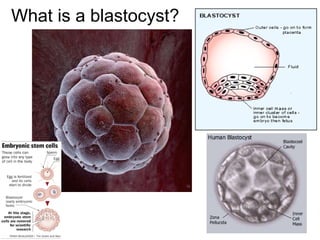 What is a blastocyst? 