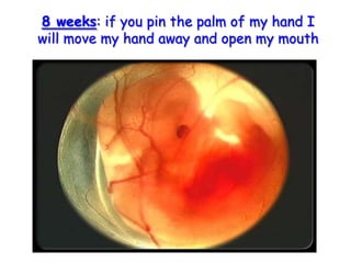 8 weeks: if you pin the palm of my hand I will move my hand away and open my mouth