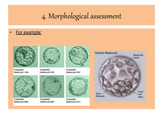 4. Morphological assessment
• For example:
 