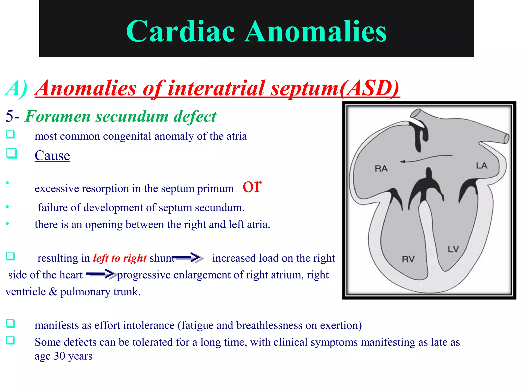 Cardiac Anomalies
A) Anomalies of interatrial septum(ASD)
5- Foramen secundum defect
 most common congenital anomaly of the atria
 Cause
• excessive resorption in the septum primum or
• failure of development of septum secundum.
• there is an opening between the right and left atria.
 resulting in left to right shunt increased load on the right
side of the heart progressive enlargement of right atrium, right
ventricle & pulmonary trunk.
 manifests as effort intolerance (fatigue and breathlessness on exertion)
 Some defects can be tolerated for a long time, with clinical symptoms manifesting as late as
age 30 years
 