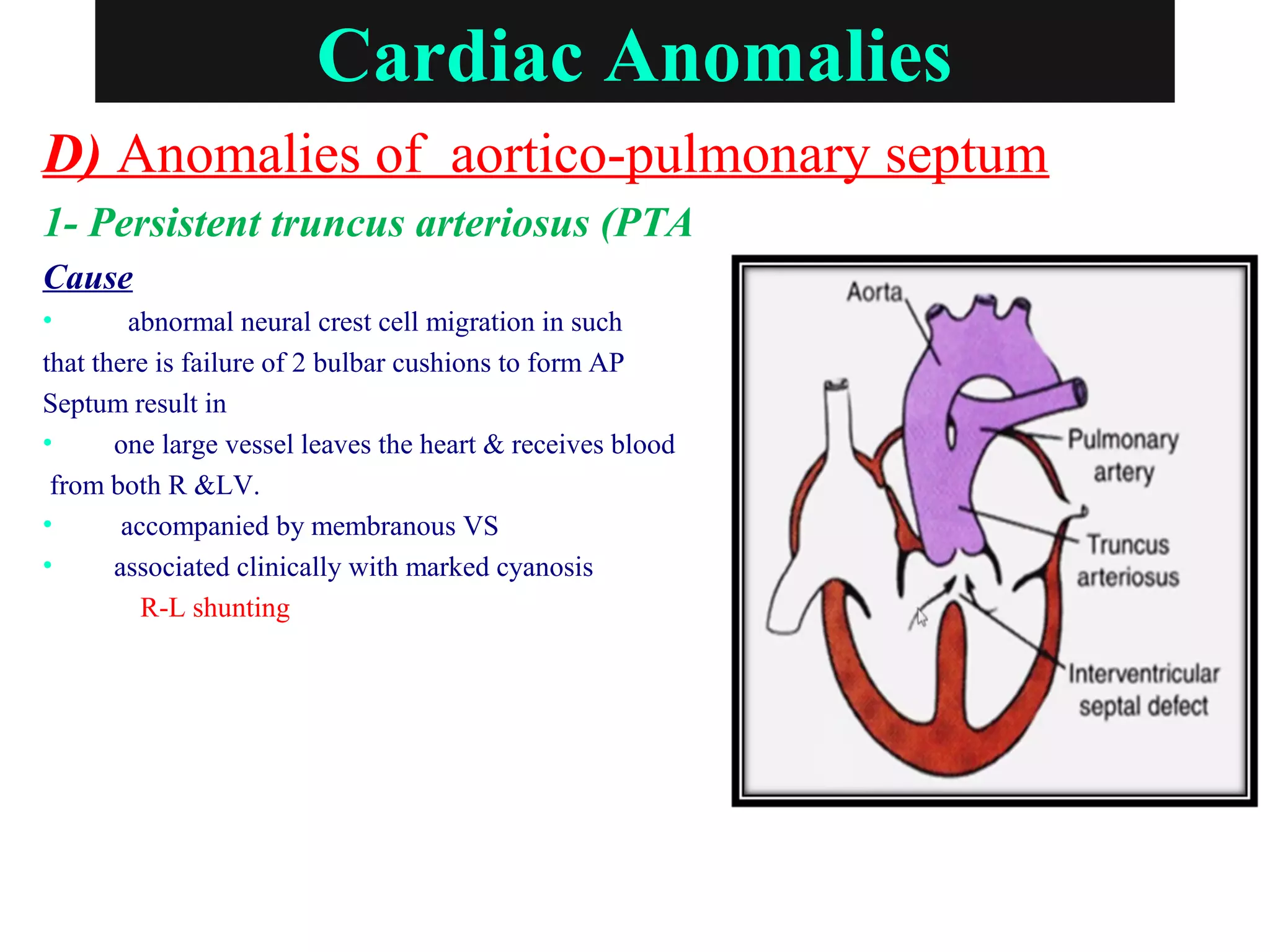 Cardiac Anomalies
D) Anomalies of aortico-pulmonary septum
1- Persistent truncus arteriosus (PTA
Cause
• abnormal neural crest cell migration in such
that there is failure of 2 bulbar cushions to form AP
Septum result in
• one large vessel leaves the heart & receives blood
from both R &LV.
• accompanied by membranous VS
• associated clinically with marked cyanosis
R-L shunting
 