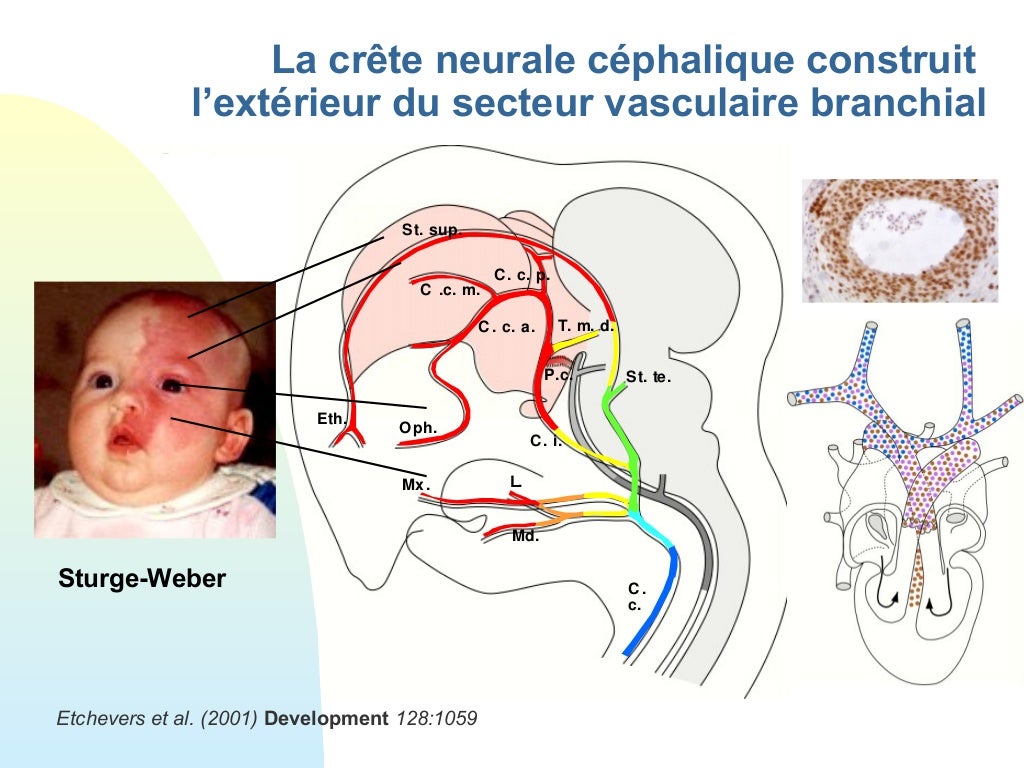 Embryologie cardiaque crête neurale