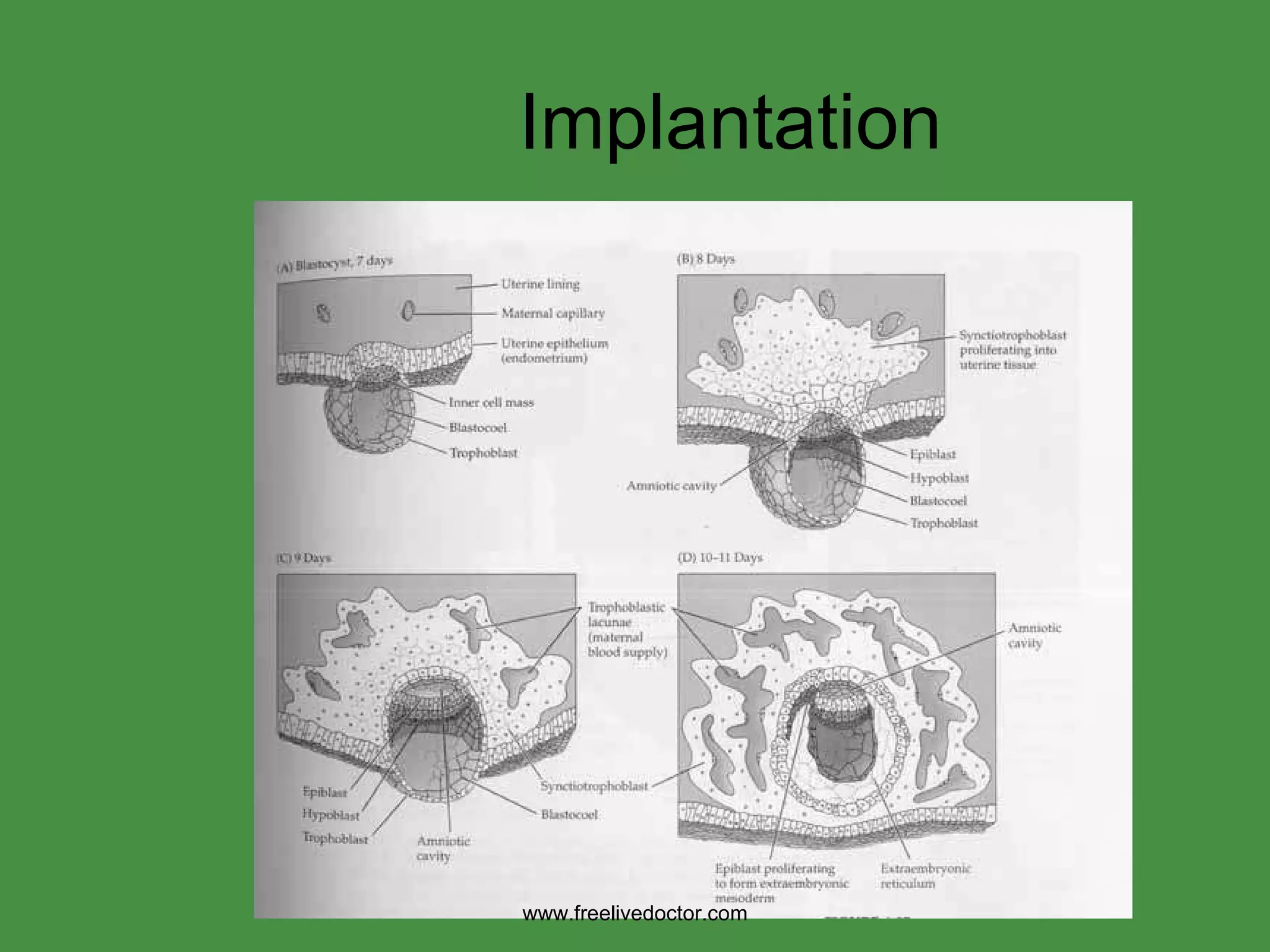 Implantation www.freelivedoctor.com 