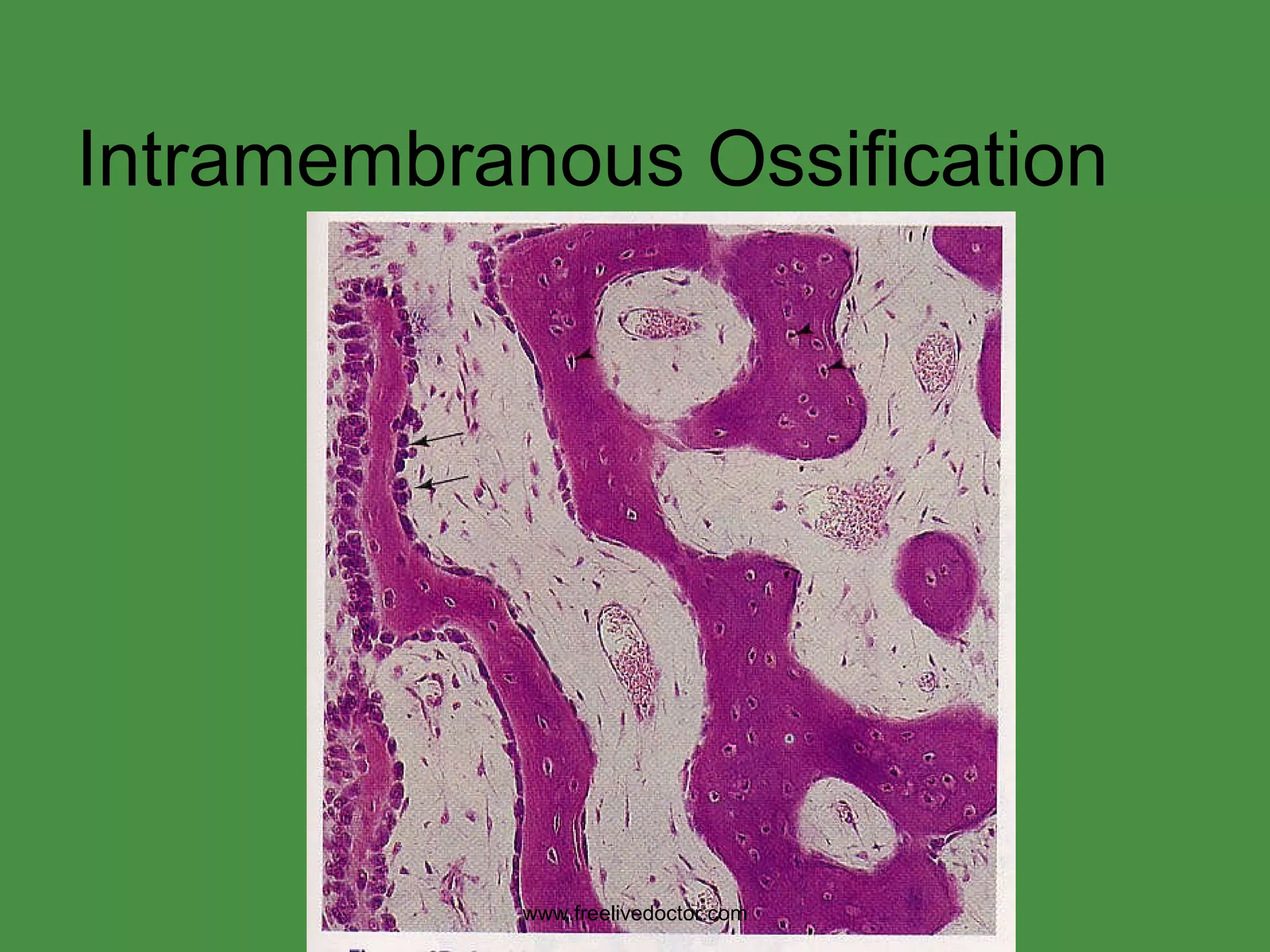 Intramembranous Ossification www.freelivedoctor.com 